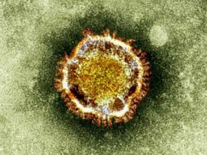 Dos nuevos virus respiratorios "podrían causar una epidemia global"